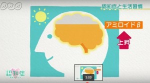 2015y08m29d_032143929