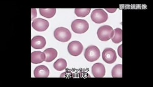 2015y08m29d_140442519