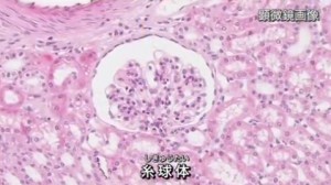 2015y09m02d_065211037