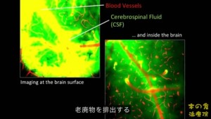 2015y11m04d_063906605